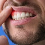 I terribili pericoli della malattia parodontale non curata
